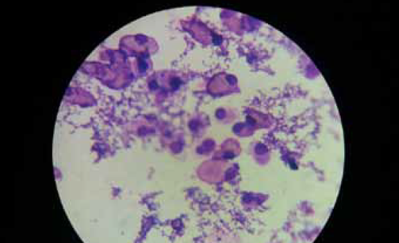 Pododermatitis Surgical Intervention in a Savannah Monitor (Varanus exanthematicus)