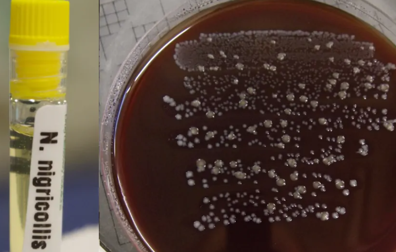 Study Questions Sterility of Snake and Spider Venoms